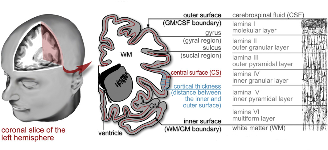 Cortical Thickness