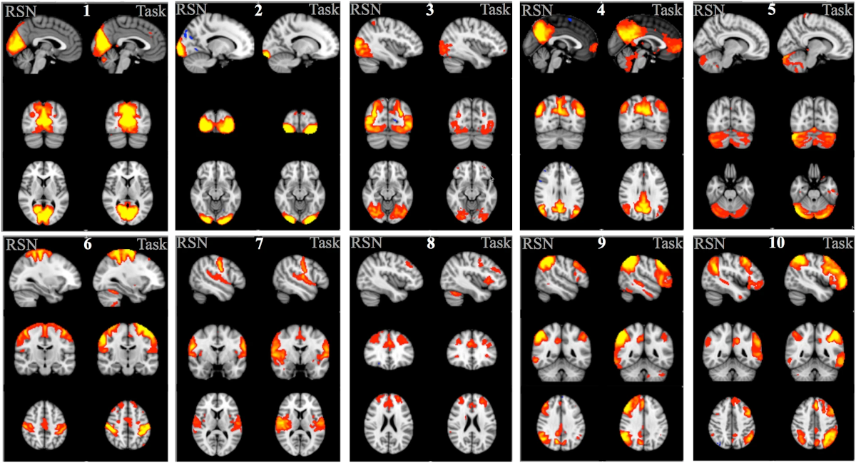 Resting State Networks